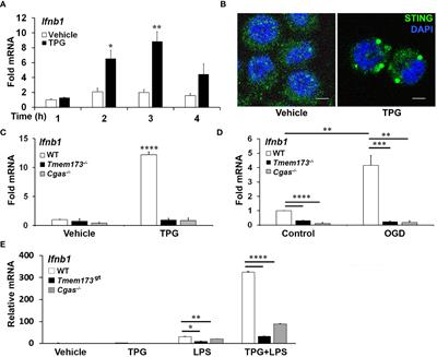 Multiple unfolded protein response pathways cooperate to link cytosolic dsDNA release to stimulator of interferon gene activation